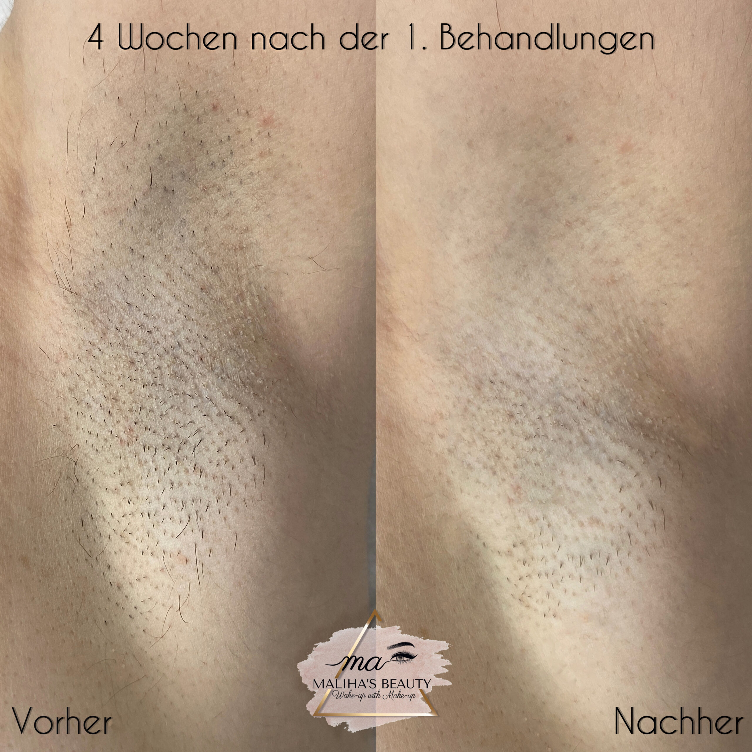 Dauerhafte Haa3